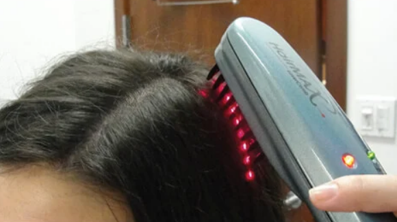 Low Level Laser Therapy (LLLT) - New Hair Clinic