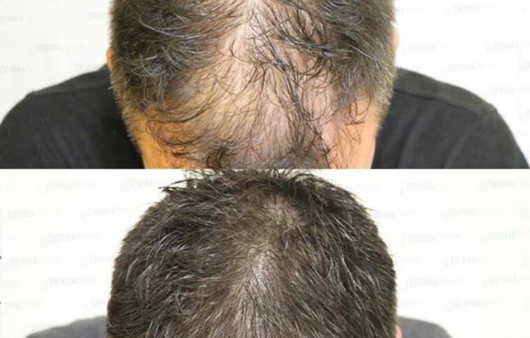 We Specialize in Hair Retention, Hair Replacement, and Hair Restoration