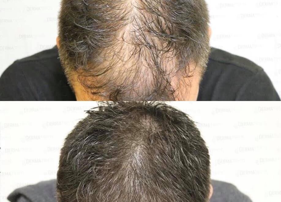 We Specialize in Hair Retention, Hair Replacement, and Hair Restoration